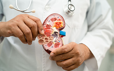 cálculo urinário e pedras nos rins