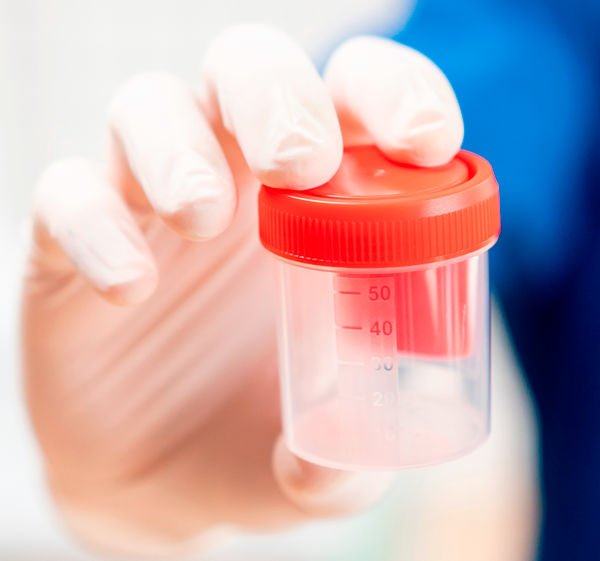 cirurgiao vasectomia no tatuapé