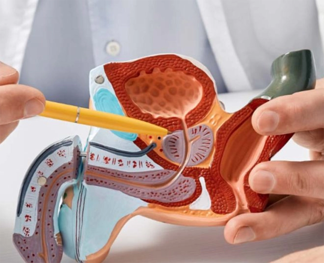 Doenças Oncológicas Masculinas